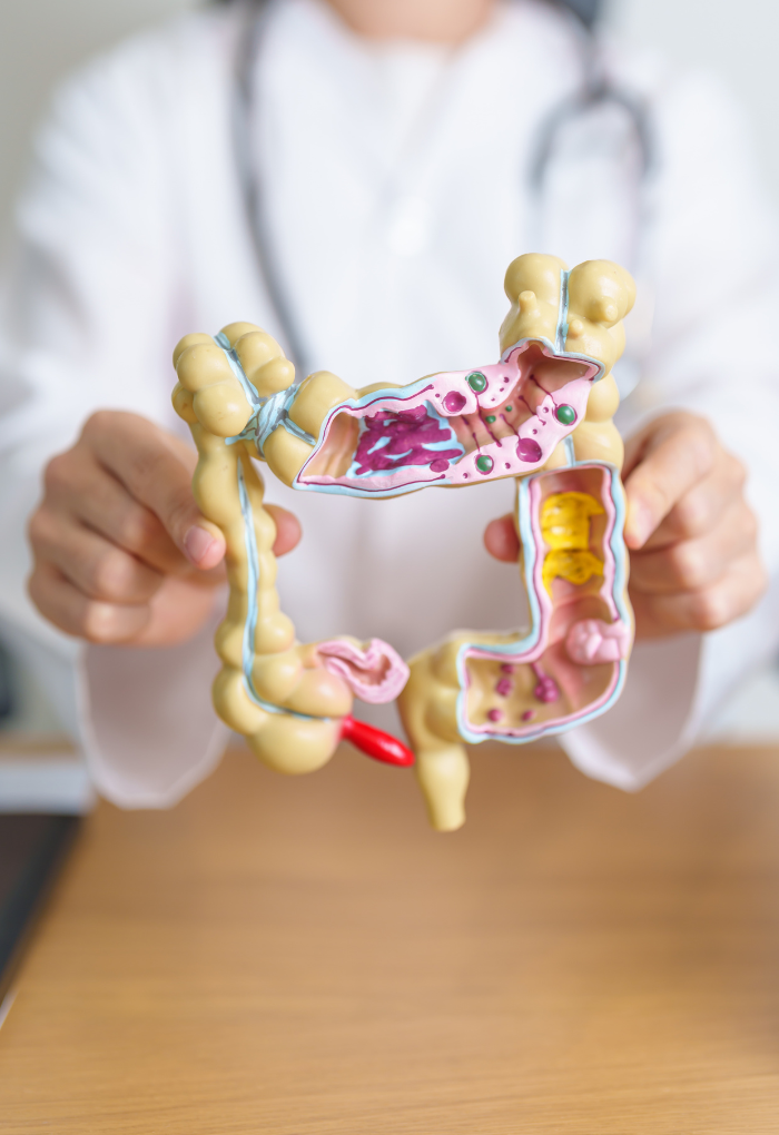 modelo-colon-deteccion-cancer-colorrectal-mexico