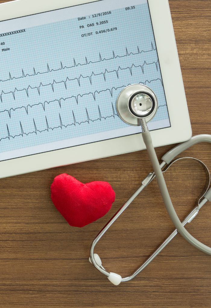 Electrocardiograma en pantalla con estetoscopio y figura de corazón representando monitoreo de salud cardíaca